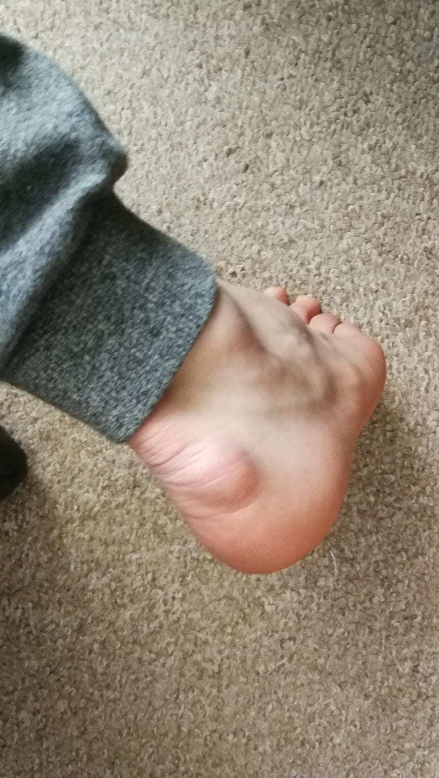 The Most Common Climbing Injuries and How to Prevent Them Rock